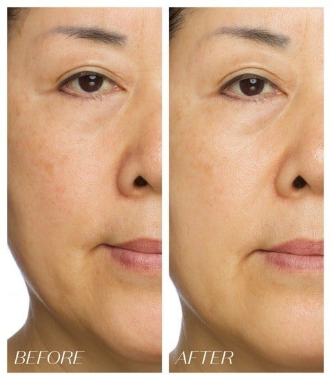 Dark Spot Corrector and Brightening Cream Dark Spot Corrector and Brightening Cream
