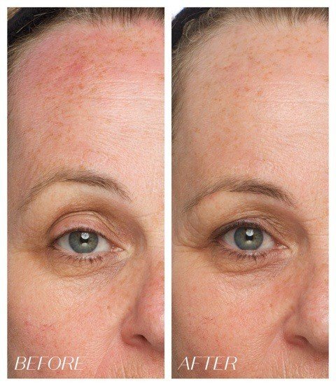 Dark Spot Corrector and Brightening Cream Dark Spot Corrector and Brightening Cream