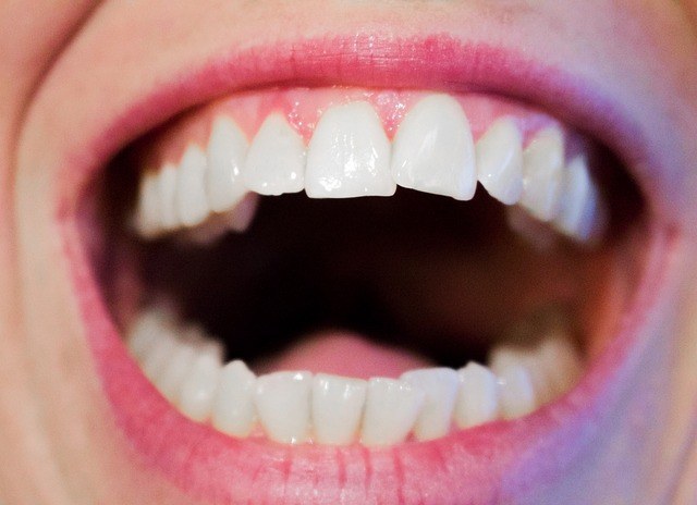 How to Whiten Teeth in 5 Natural Ways
