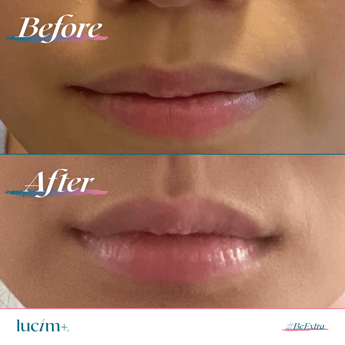 Lucim Lip Plumping Gloss Before - After