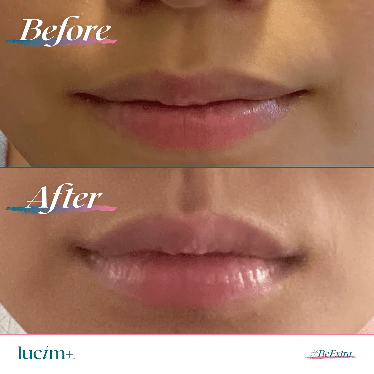 Lucim Lip Plumping Gloss Before - After